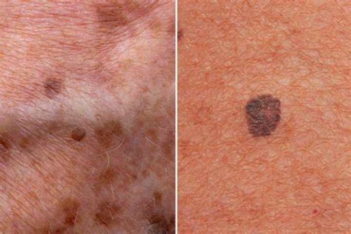 Does cornmeal have black spots?