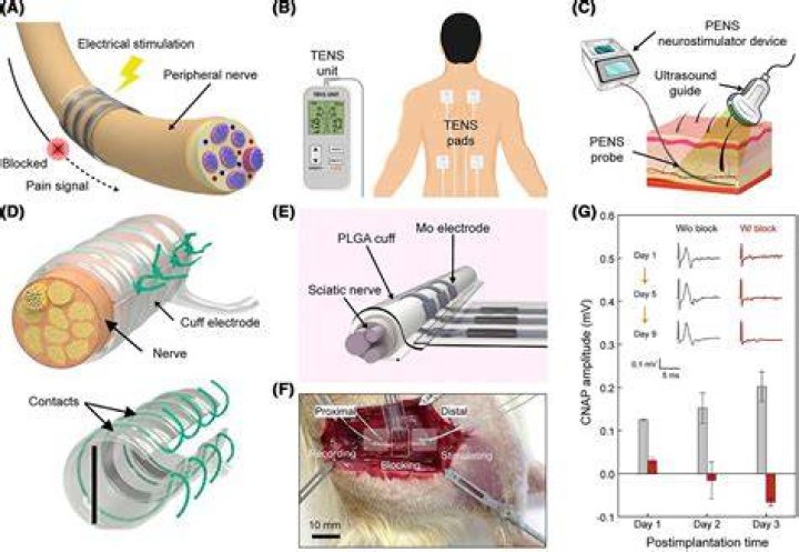 Does electrical stimulation increase blood flow?